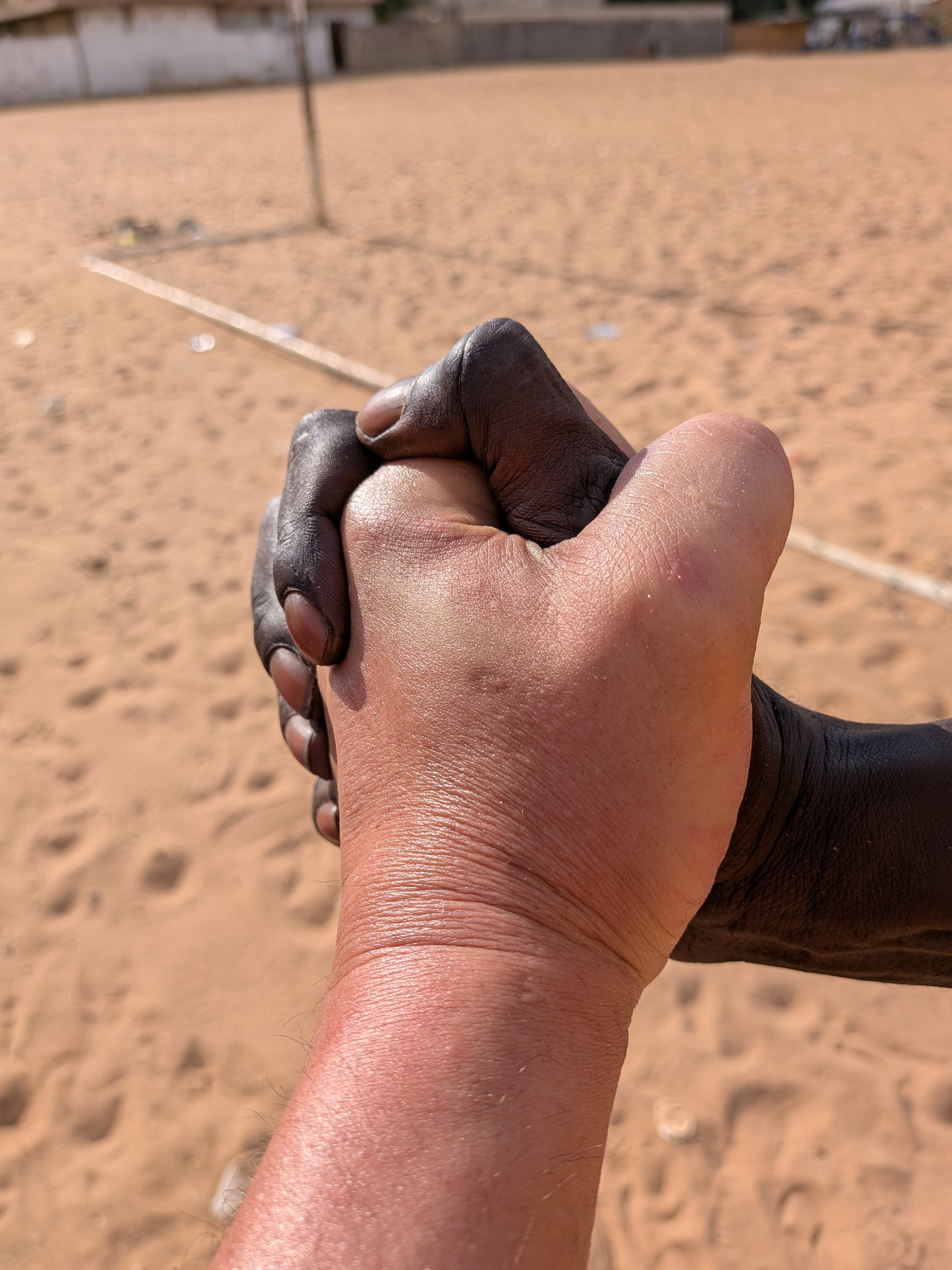 Foto SAGE Hospital, Warang · Senegal